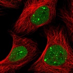 Immunofluorescent staining of human cell line U-2 OS shows localization to nuclear bodies.