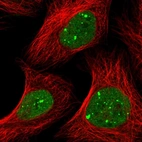 Immunofluorescent staining of human cell line U-2 OS shows localization to nuclear bodies.