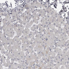 Immunohistochemical staining of human liver shows no positivity in hepatocytes as expected.