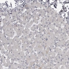Immunohistochemical staining of human liver shows no positivity in hepatocytes as expected.