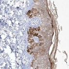 Anti-SIRT3 Antibody