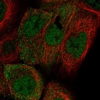 Immunofluorescent staining of human cell line A-431 shows localization to nucleoplasm & cytosol.