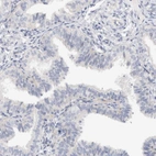 Immunohistochemical staining of human fallopian tube shows no cytoplasmic positivity in glandular cells as expected.