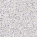 Anti-SPINK2 Antibody