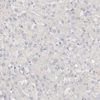 Immunohistochemical staining of human liver shows no cytoplasmic positivity in hepatocytes as expected.
