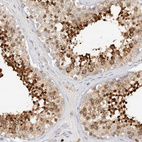 Anti-SPINK2 Antibody