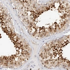 Immunohistochemical staining of human testis shows strong cytoplasmic positivity in cells in seminiferous ducts.