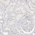 Anti-SPINK2 Antibody