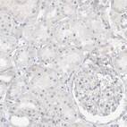 Immunohistochemical staining of human kidney shows no cytoplasmic positivity in cells in tubules as expected.
