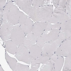 Immunohistochemical staining of human Skeletal muscle shows very weak positivity in endoplasmic reticulum in myocytes.