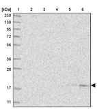 Lane 1: Marker [kDa] 230, 130, 95, 72, 56, 36, 28, 17, 11_br/_Lane 2: Human cell line RT-4_br/_Lane 3: Human cell line U-251MG sp_br/_Lane 4: Human plasma (IgG/HSA depleted)_br/_Lane 5: Human liver tissue_br/_Lane 6: Human tonsil tissue