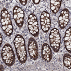 Immunohistochemical staining of human rectum shows strong membranous positivity in glandular cells.
