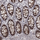 Immunohistochemical staining of human rectum shows strong membranous positivity in glandular cells.