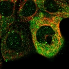 Immunofluorescent staining of human cell line A-431 shows localization to plasma membrane, cytosol & vesicles.