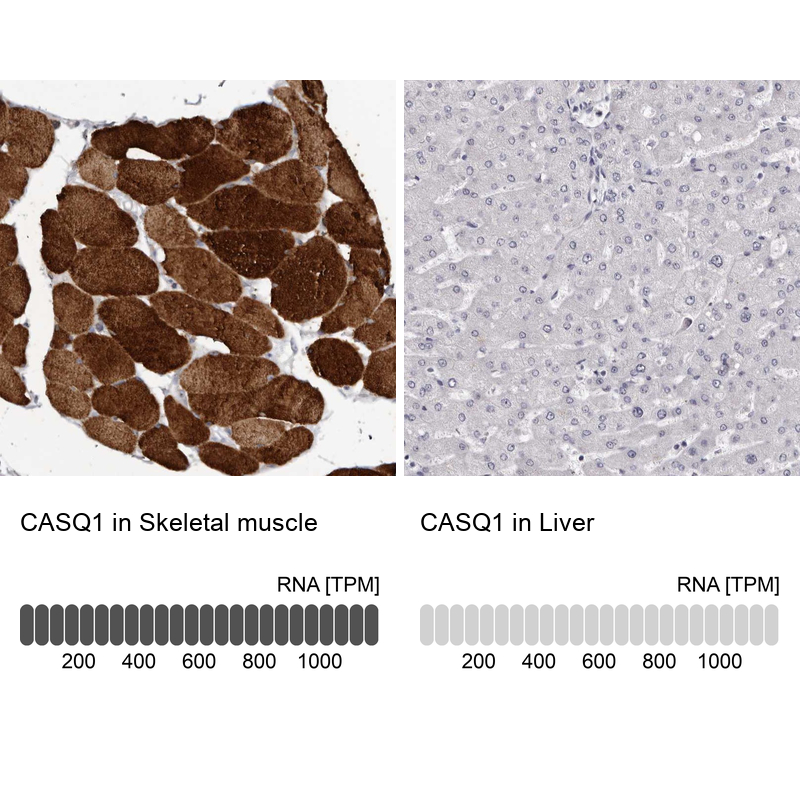 Anti-CASQ1 Antibody