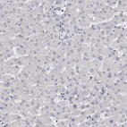 Immunohistochemical staining of human liver shows low expression as expected.