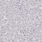 Anti-CASQ1 Antibody