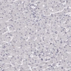 Immunohistochemical staining of human liver shows low expression as expected.