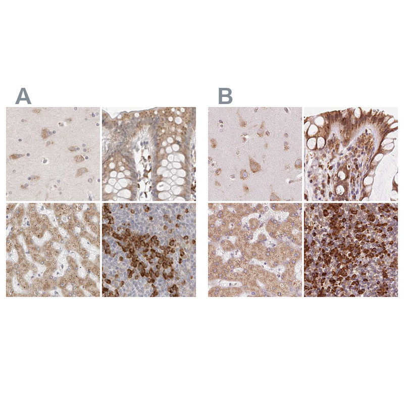 Anti-RPN1 Antibody