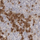 Immunohistochemical staining of human tonsil using Anti-RPN1 antibody HPA026828.