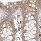 Immunohistochemical staining of human colon using Anti-RPN1 antibody HPA026828.