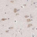 Immunohistochemical staining of human cerebral cortex using Anti-RPN1 antibody HPA026828.