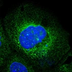 Immunofluorescent staining of human cell line A-431 shows localization to endoplasmic reticulum.