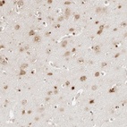 Anti-FKBP14 Antibody