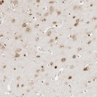 Anti-FKBP14 Antibody