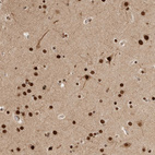 Anti-C1orf21 Antibody