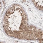 Anti-PTPDC1 Antibody