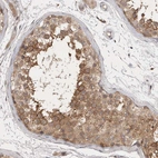 Anti-PTPDC1 Antibody
