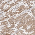 Immunohistochemical staining of human heart muscle shows moderate cytoplasmic positivity in cardiomyocytes.