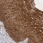 Immunohistochemical staining of human Cervix, uterine shows strong cytoplasmic positivity in squamous epithelial cells.