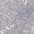 Immunohistochemical staining of human lymph node shows no positivity in non-germinal center cells as expected.