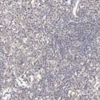 Immunohistochemical staining of human lymph node shows no positivity in non-germinal center cells as expected.