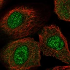 Immunofluorescent staining of human cell line A-431 shows localization to nucleoplasm.