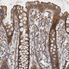 Immunohistochemical staining of human rectum shows moderate cytoplasmic positivity in glandular cells.