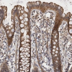 Immunohistochemical staining of human rectum shows moderate cytoplasmic positivity in glandular cells.