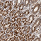 Immunohistochemical staining of human stomach shows strong cytoplasmic positivity in glandular cells.