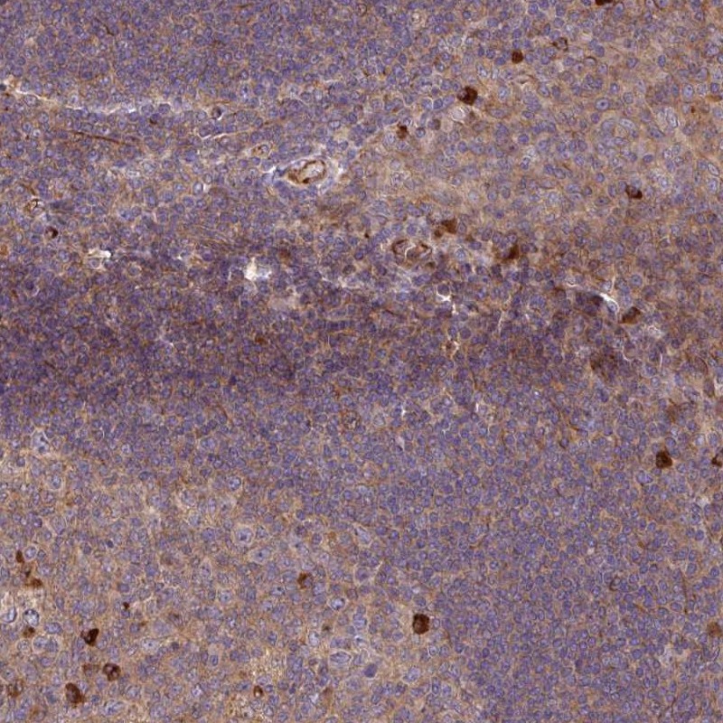 Anti-ZNF266 Antibody