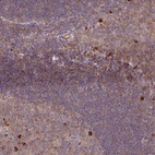 Anti-ZNF266 Antibody