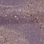 Anti-ZNF266 Antibody