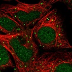 Immunofluorescent staining of human cell line HEK 293 shows localization to nucleus & vesicles.