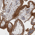 Immunohistochemical staining of human placenta show strong cytoplasmic positivity in trophoblastic cells.