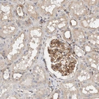 Immunohistochemical staining of human kidney shows moderate cytoplasmic positivity in cells in glomeruli.