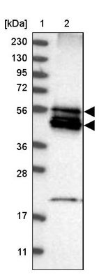 Lane 1: Marker [kDa] 230, 130, 95, 72, 56, 36, 28, 17, 11_br/_Lane 2: Human cell line RT-4
