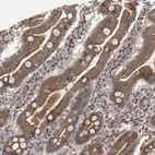 Immunohistochemical staining of human duodenum shows strong membranous positivity in glandular cells.