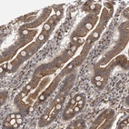 Immunohistochemical staining of human duodenum shows strong membranous positivity in glandular cells.