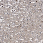 Immunohistochemical staining of human Liver shows very weak membranous positivity in hepatocytes.